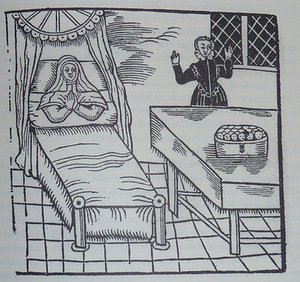 Kunigaikštienės van Haneberg gimdymas, 1620 m., Jan Bondeson, „The Two-Headed Boy“, Olandija